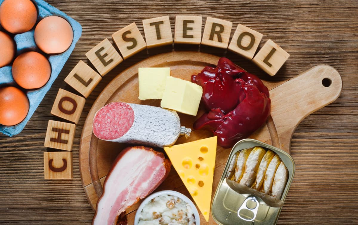 High-cholesterol foods including eggs, butter, cheese, sausage, liver, bacon, sardines, and lard displayed on a wooden board.